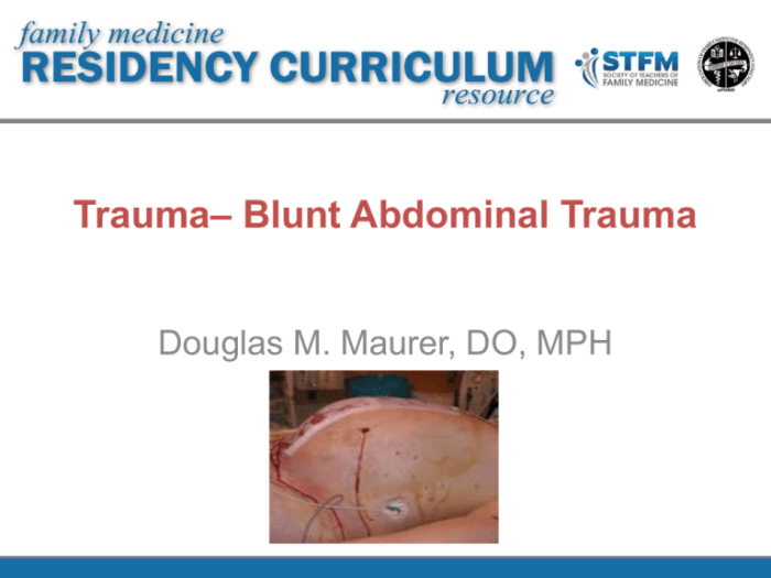 Trauma blunt abdomen